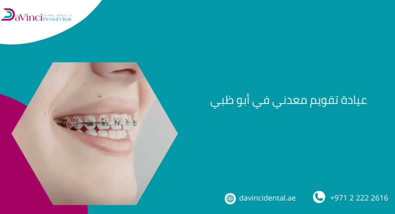 عيادة تقويم معدني في أبو ظبي