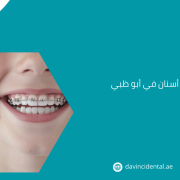 أفضل مركز تقويم أسنان في أبو ظبي لعام 2026 – دافنشي
