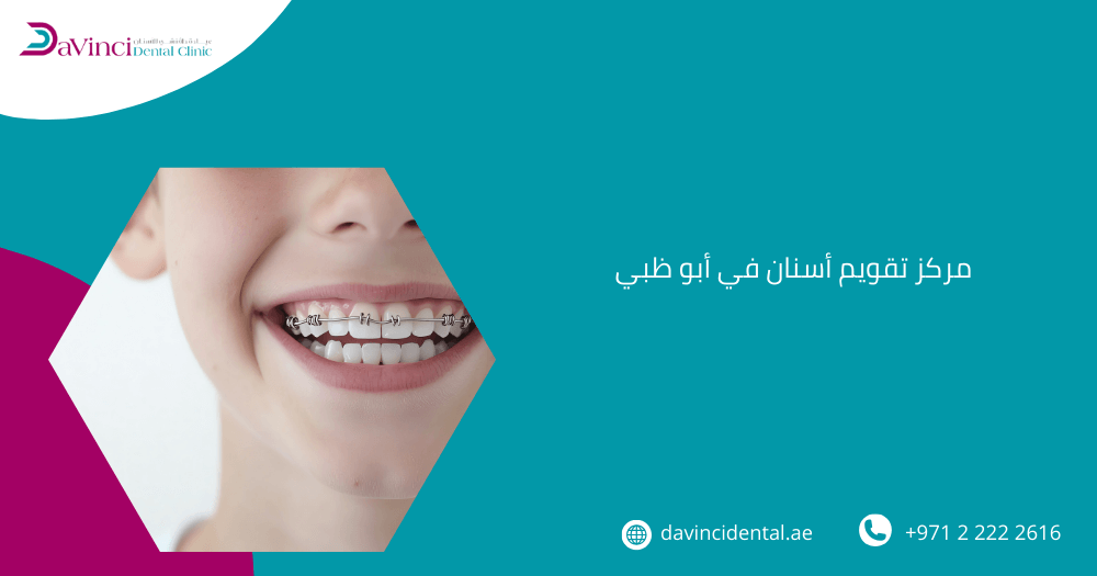مركز تقويم أسنان في أبو ظبي