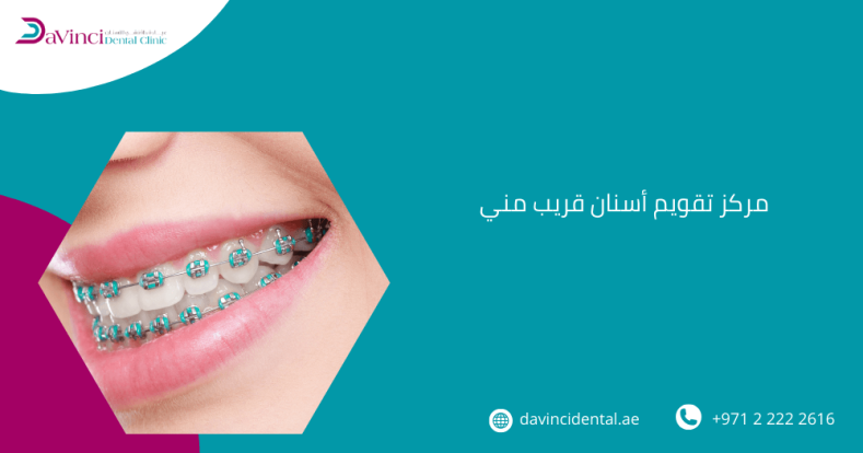 مركز تقويم أسنان قريب مني