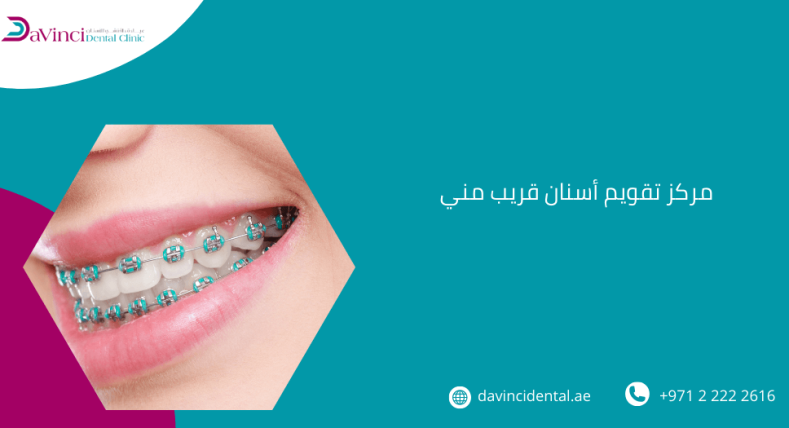 مركز تقويم أسنان قريب مني
