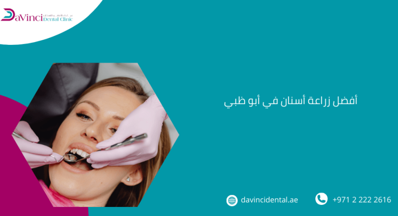 أفضل زراعة أسنان في أبو ظبي