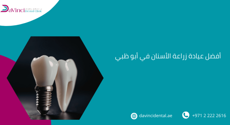 أفضل عيادة زراعة الأسنان في أبو ظبي