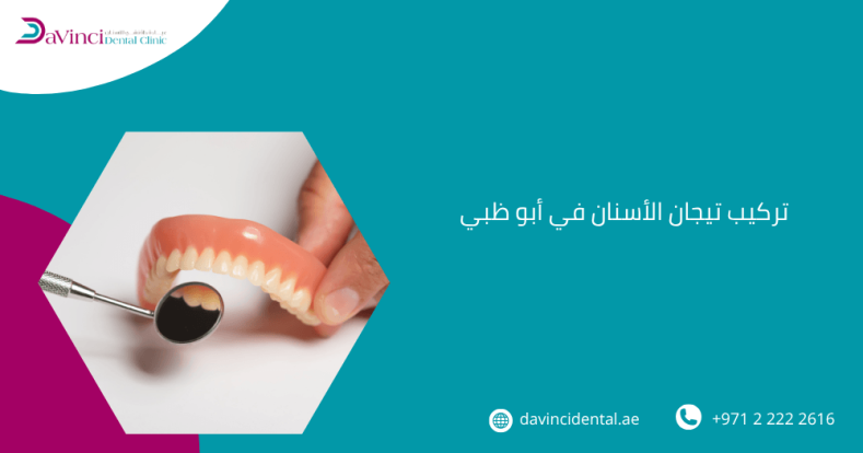 تركيب تيجان الأسنان في أبو ظبي