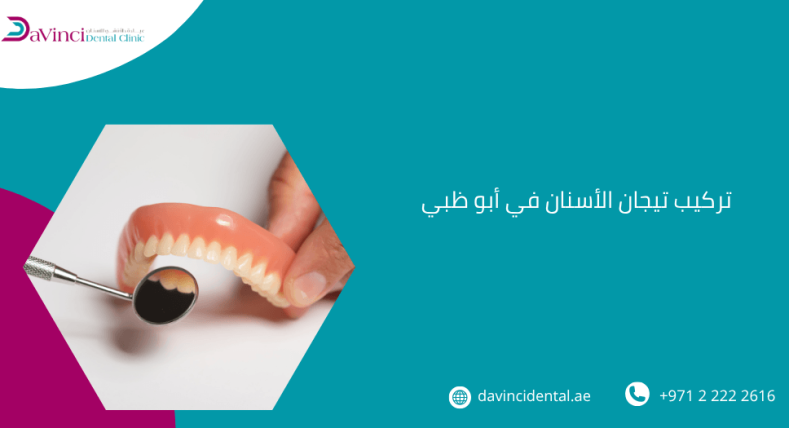 تركيب تيجان الأسنان في أبو ظبي