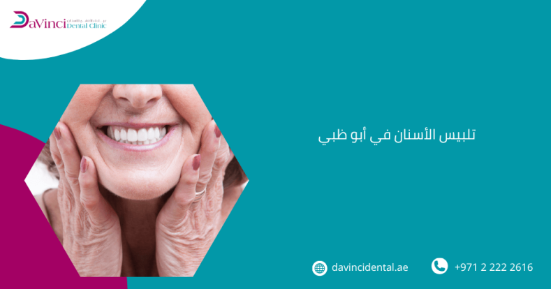 تلبيس الأسنان في أبو ظبي