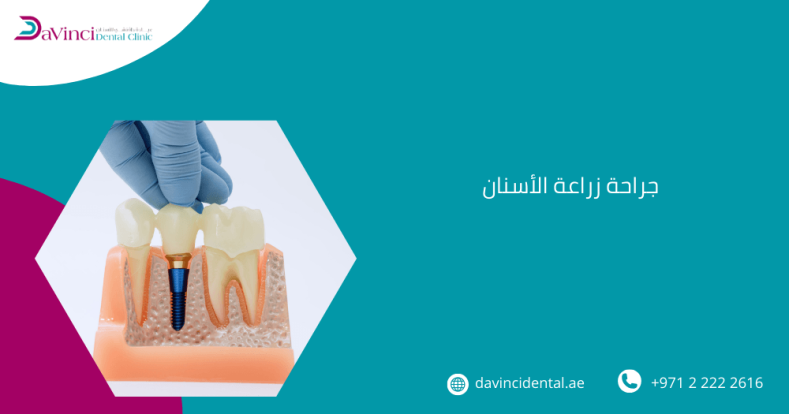 جراحة زراعة الأسنان
