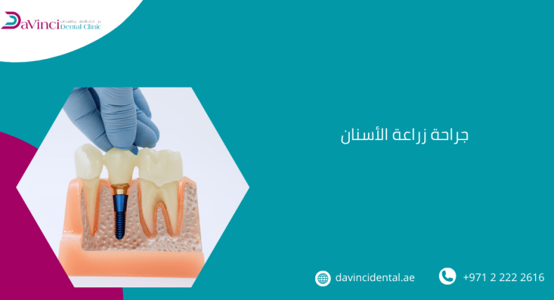 جراحة زراعة الأسنان