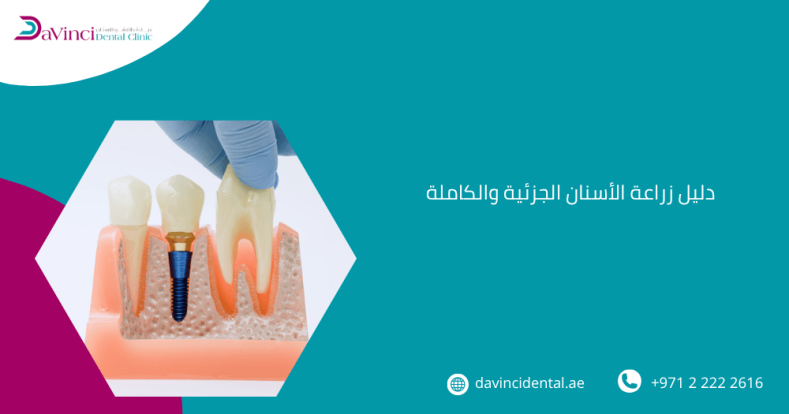 دليل زراعة الأسنان الجزئية والكاملة