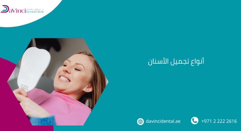 أنواع تجميل الأسنان