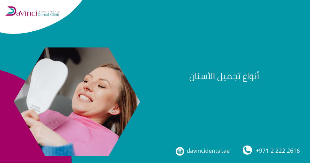 أنواع تجميل الأسنان