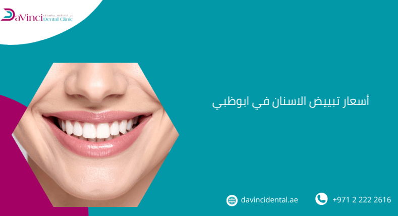 اسعار تبييض الاسنان في ابوظبي