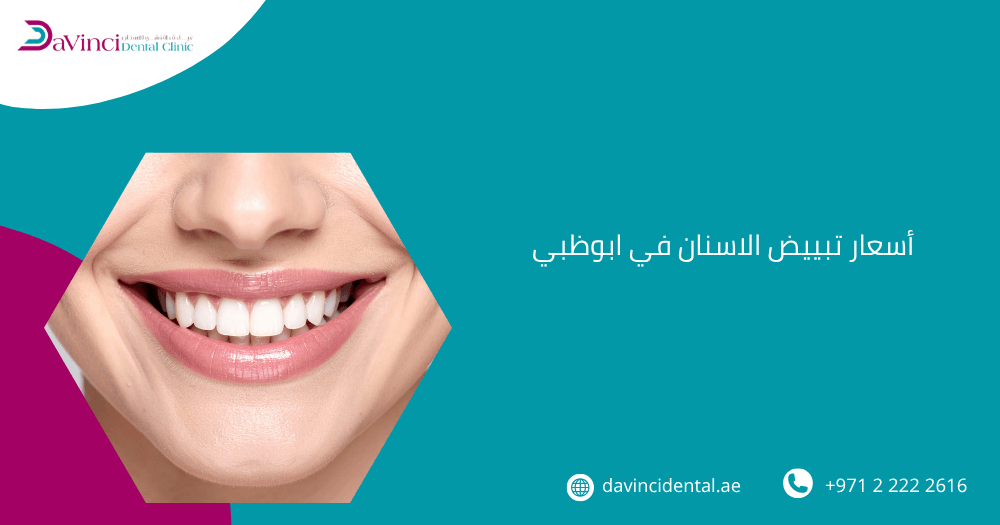اسعار تبييض الاسنان في ابوظبي