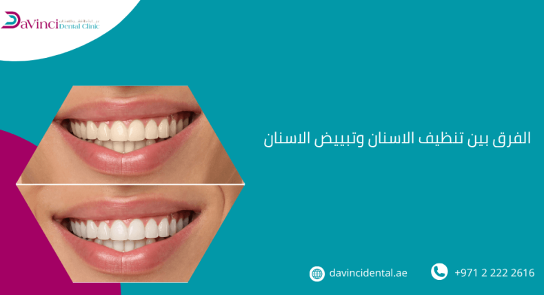 الفرق بين تنظيف الاسنان وتبييض الاسنان