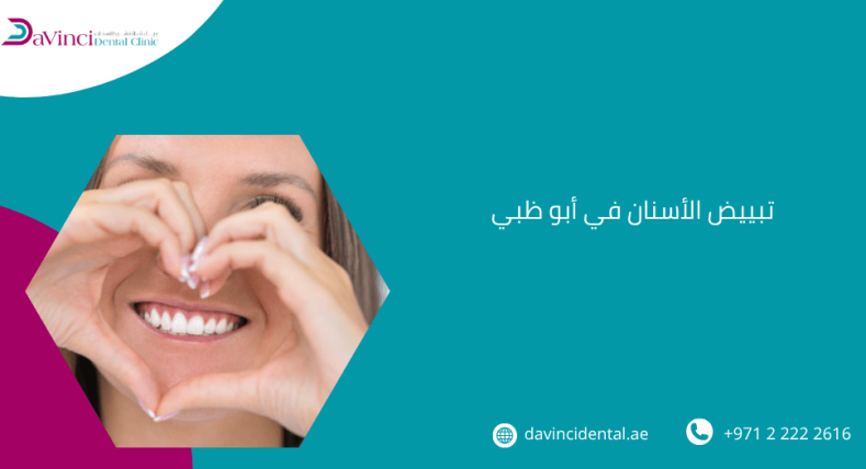 تبييض الأسنان في ابوظبي