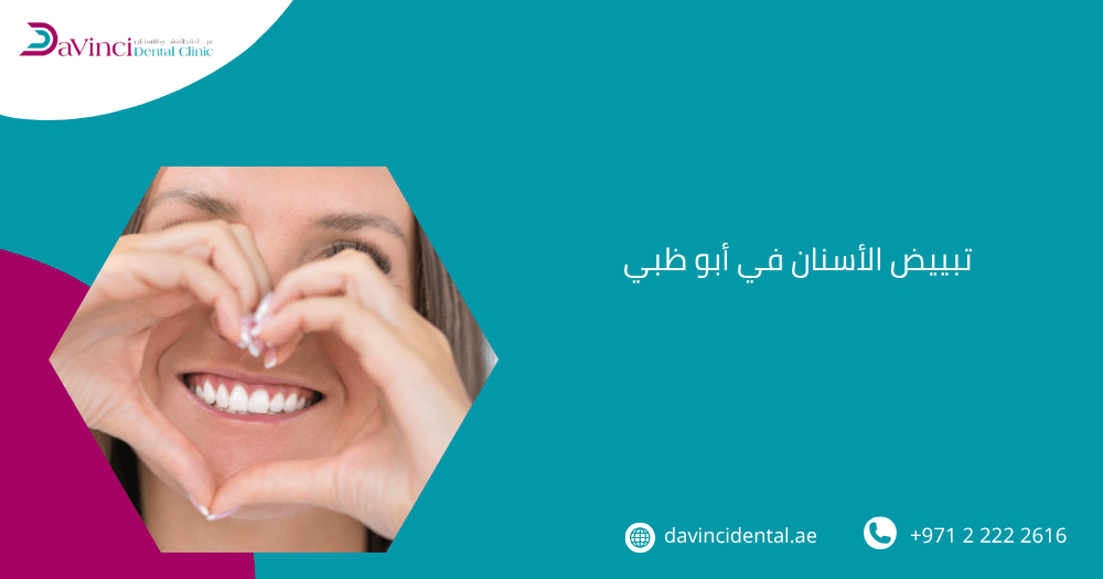 تبييض الأسنان في ابوظبي