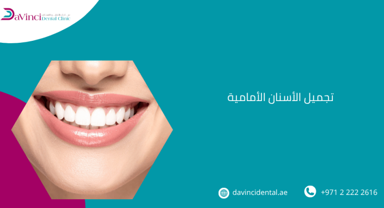 تجميل الأسنان الأمامية