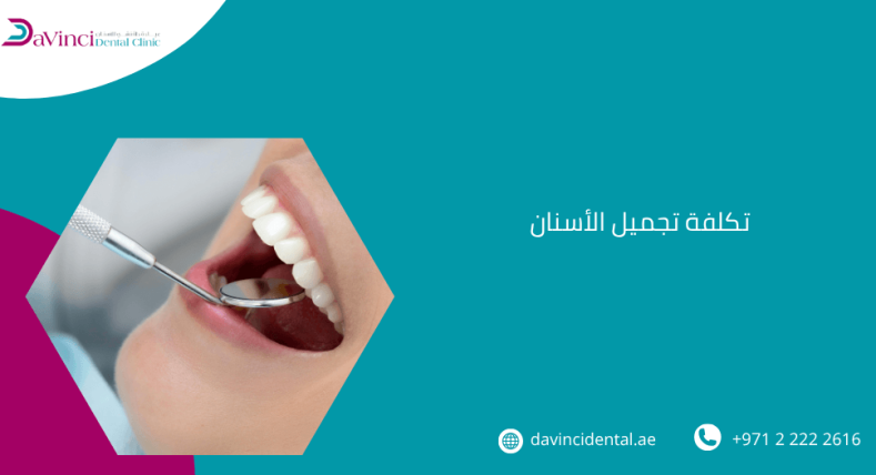 تكلفة تجميل الأسنان