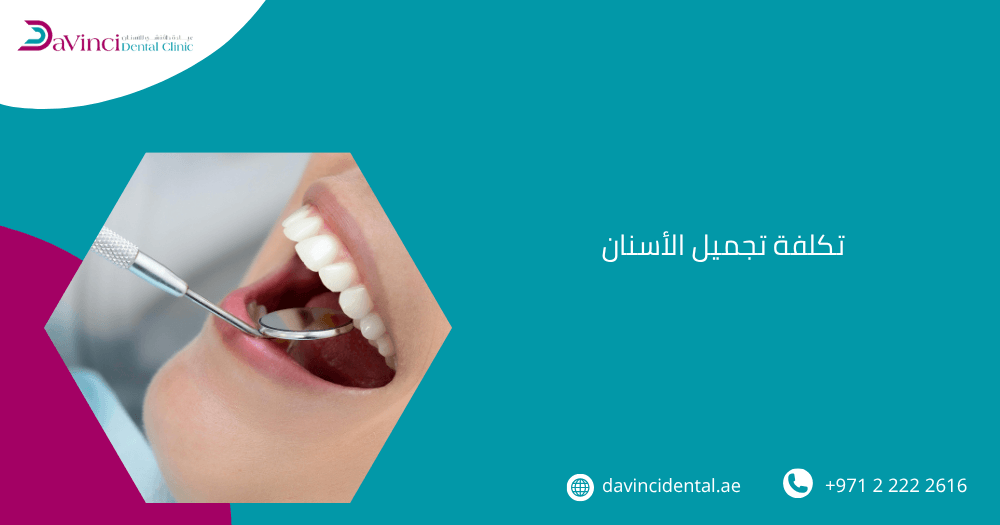 تكلفة تجميل الأسنان