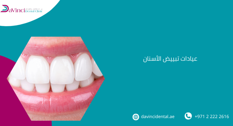 عيادات تبييض الاسنان