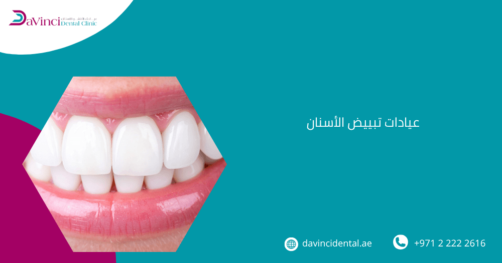 عيادات تبييض الاسنان