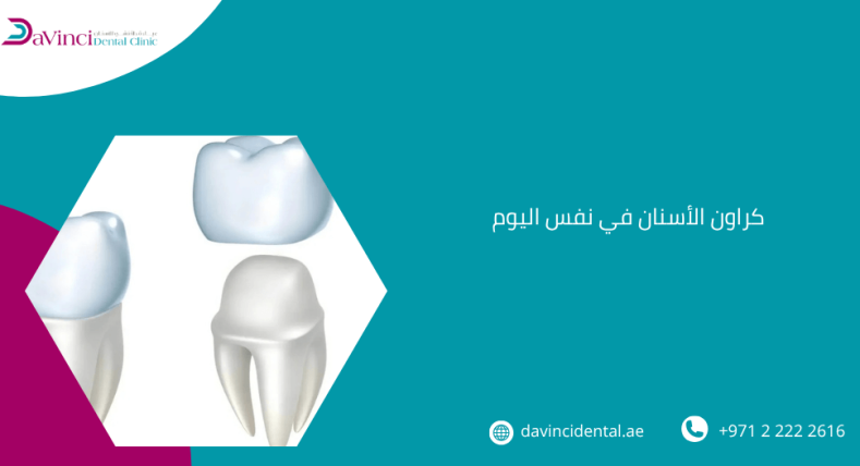 كراون الأسنان في نفس اليوم