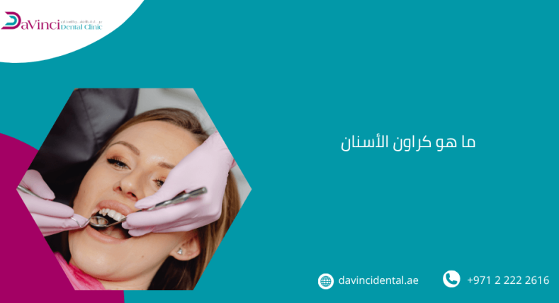 ما هو كراون الأسنان