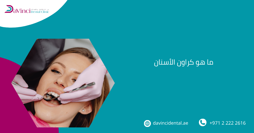 ما هو كراون الأسنان