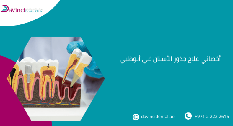 أخصائي علاج جذور الأسنان في أبوظبي