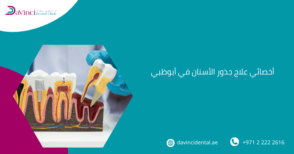 أخصائي علاج جذور الأسنان في أبوظبي