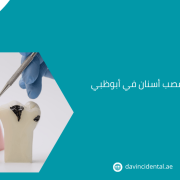 أفضل أخصائيين عصب أسنان في أبوظبي لعام 2026