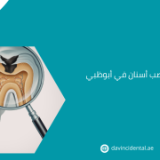 أفضل دكتور عصب أسنان في أبوظبي لعام 2026
