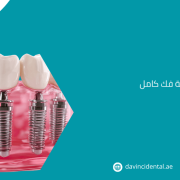 أفضل عيادة زراعة فك كامل في أبوظبي لعام 2026 | دافنشي
