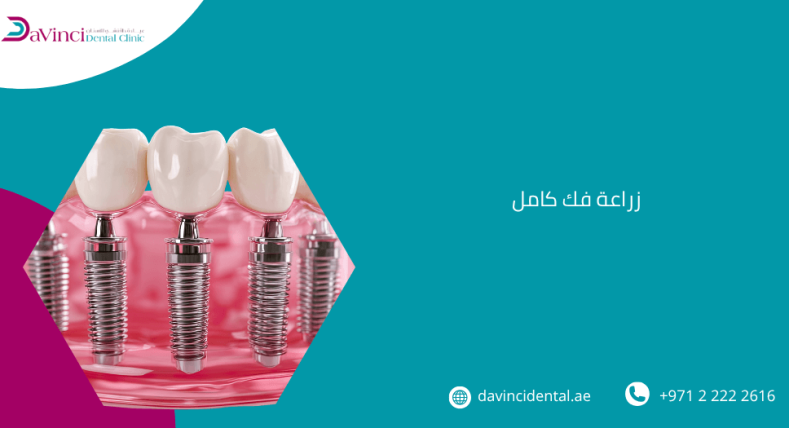 زراعة فك كامل