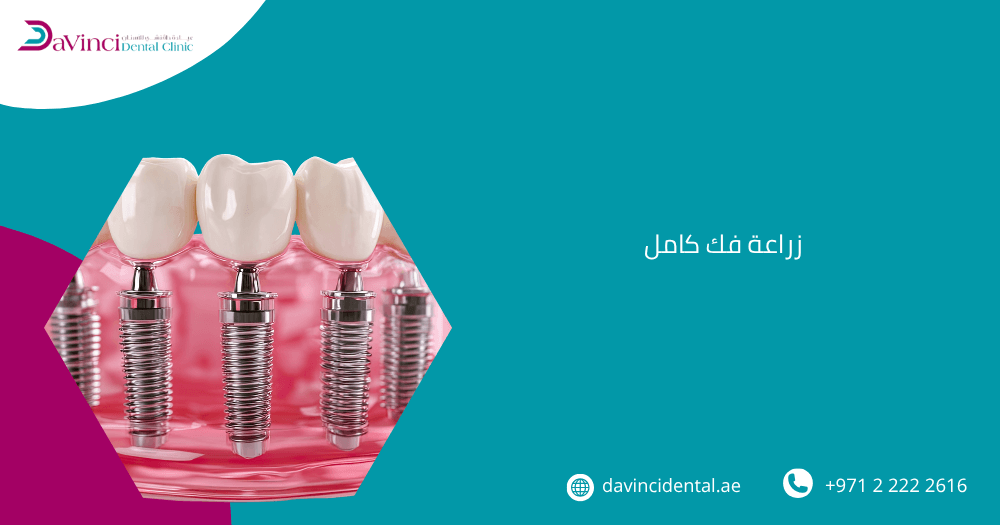 زراعة فك كامل