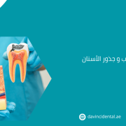 علاج أعصاب و جذور الأسنان في أبوظبي