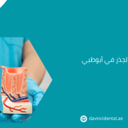 علاج قناة الجذر في أبوظبي | دافنشي