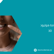 ابتسامة هوليود 3D في أبوظبي | أسنان متناسقة وناصعة البياض