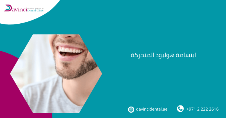 ابتسامة هوليود المتحركة