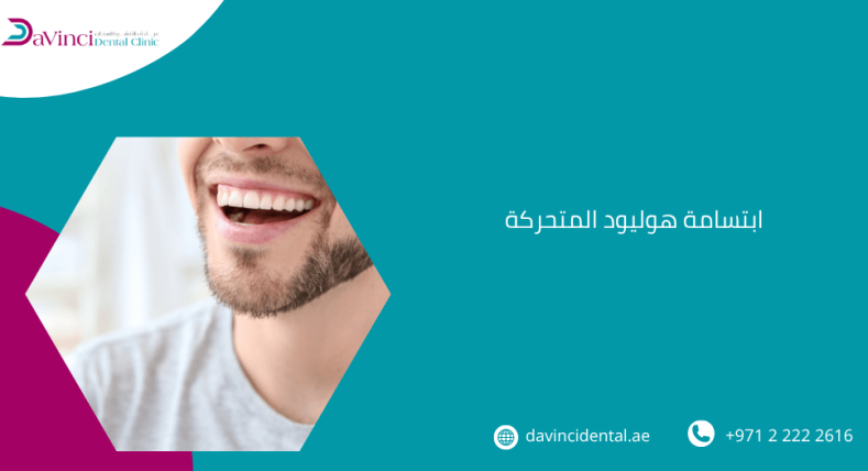 ابتسامة هوليود المتحركة