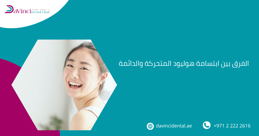 الفرق بين ابتسامة هوليود المتحركة والدائمة